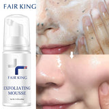 Fair King Exfoliating Mouss | Foaming Exfoliating Mousse | Retiredgrma