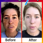 Remove Dark Spots Effective Whitening Freckles Cream