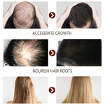 Growth Hair Oil | Best Hair Oil | Retiredgrma