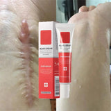 Scar Stretch Marks Remover Cream