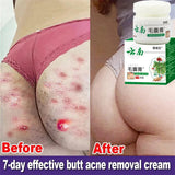 Body Acne Removal Cream Treatment Face Butt Back Acne Marks Smooth Repair Chicken Skin Cream