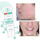 Tea Tree Acne Treatment Cream