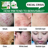 Acne Cream Herbal Extracts to Eliminate Acne and Acne Marks