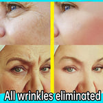 Anti-Wrinkle Facial Serum | Aichun Beauty | Retiredgrma