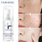 Fair King Exfoliating Mouss | Foaming Exfoliating Mousse | Retiredgrma