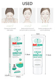 Tea Tree Acne Treatment Cream