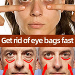 Dark circles cream and eye bag anti bags in the eyes circle remover