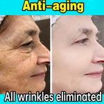 Anti-Wrinkle Facial Serum | Aichun Beauty | Retiredgrma