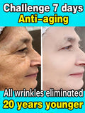 Anti-Wrinkle Facial Serum | Aichun Beauty | Retiredgrma