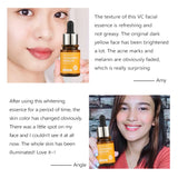 Vitamin C Face Serum | Vitamin C for Face | Retiredgrma