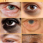Dark circles cream and eye bag anti bags in the eyes circle remover