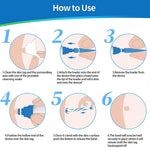 Skin Tag Remover Kit | Skin Tag Removal | Retiredgrma