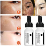 Niacinamide Dark Spots Remover Serum Freckle