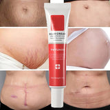 Scar Stretch Marks Remover Cream