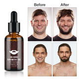 Barbe Hair Essential Oil | Barbe Growth Kit Hair | Retiredgrma