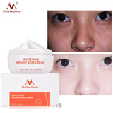 Face Whitening Freckle Cream