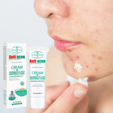 Tea Tree Acne Treatment Cream