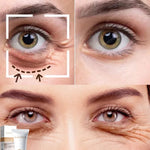 Eye Care Anti-Wrinkle Eye Cream Dark Circles Remove Eye Bags