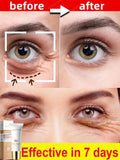 Eye Care Anti-Wrinkle Eye Cream Dark Circles Remove Eye Bags