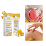 Bee Venom Bee Joint Soothing Gel Professional Treatment Gel Relieve Joint Soreness Cream