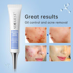  Acne Treatment Cream | Face Acne Cream | Retiredgrma