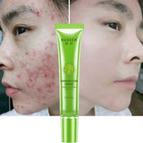 Acne Cream Acne Removal Fades Acne Marks