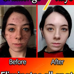 Remove Dark Spots Effective Whitening Freckles Cream
