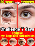 Eye Care Anti-Wrinkle Eye Cream Dark Circles Remove Eye Bags