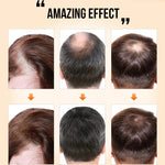 Growth Hair Oil | Best Hair Oil | Retiredgrma