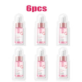 Body Acne Removal Cream Treatment Face Butt Back Acne Marks Smooth Repair Chicken Skin Cream