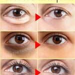 Dark circles cream and eye bag anti bags in the eyes circle remover