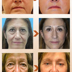 Dark circles cream and eye bag anti bags in the eyes circle remover