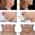 V-Shape Firming Face-lift Slimming Cream