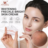 Face Whitening Freckle Cream