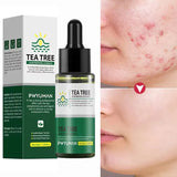 Tea Tree Acne Removal Serum Anti-Acne Gel