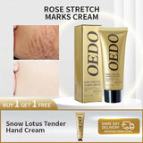 Rose Removes Stretch Mark Cream