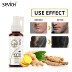 Ginger Fast-Growing Hair Loss | Ginger Juice for Hair | Retiredgrma