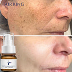 Anti Lines Facial Lotion | Anti Facial Cream | Retiredgrma