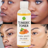 Turmeric Whitening Face Toner