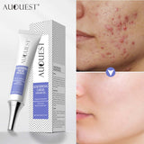 Herbal Acne Treatment Cream Pimple Spot Removal