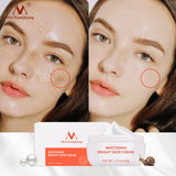 Moisturiser Face Whitening Freckle Cream